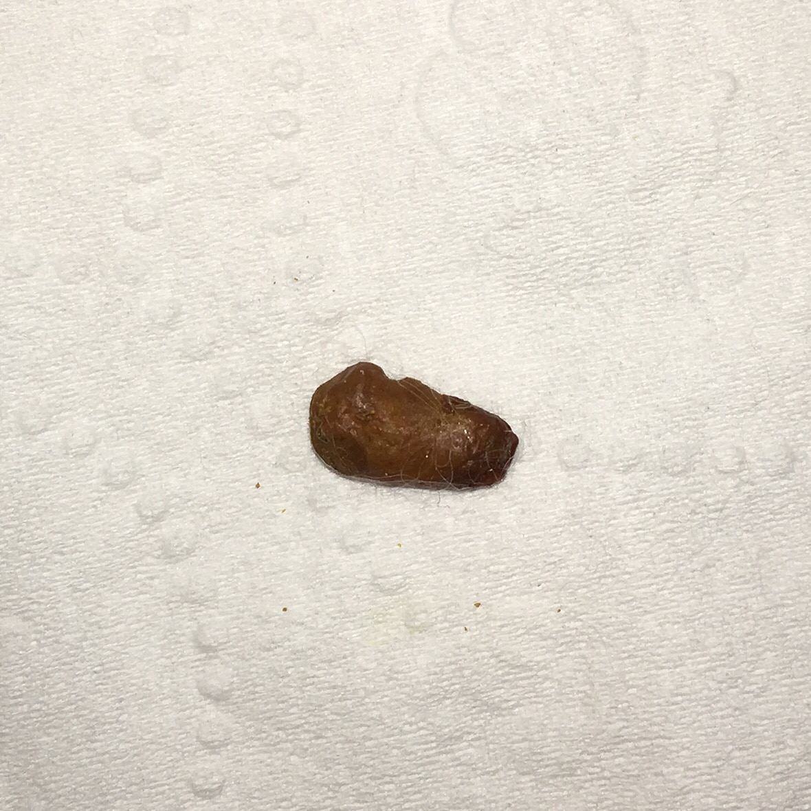 Please Help! Is This A Cat Hairball?